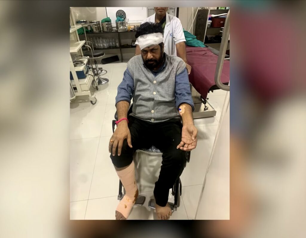 Bacchu Kadu Accident 
