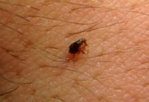 तीव्र ताप, अंगदुखी आणि मृत्यू; अनेक जिल्ह्यांमध्ये स्क्रब टायफसमुळे मोठ्या प्रमाणात दहशत